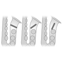 Neotech Tenor-Saxophon Tone Filter